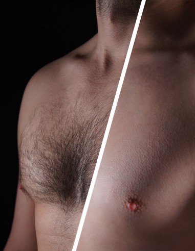 Petto maschile prima e dopo la depilazione