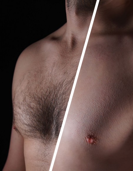 Petto maschile prima e dopo la depilazione